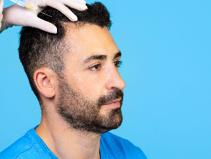 Platelet Rich Plasma (PRP) Hair Treatment